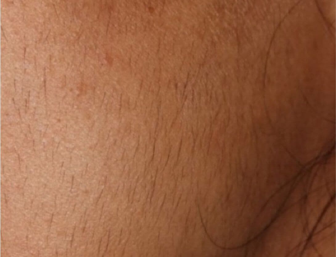 Close up of hair with skin