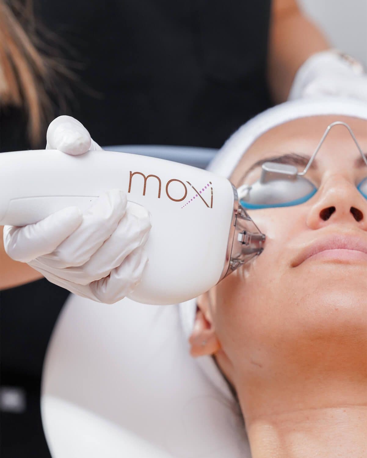 Woman's face being treated with a laser