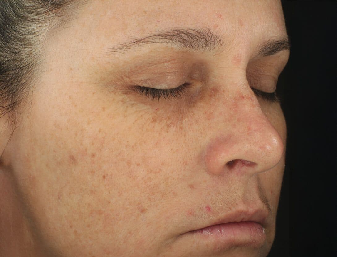 DiamondGlow-2025-01-03 at 2.43.31-After.jpg