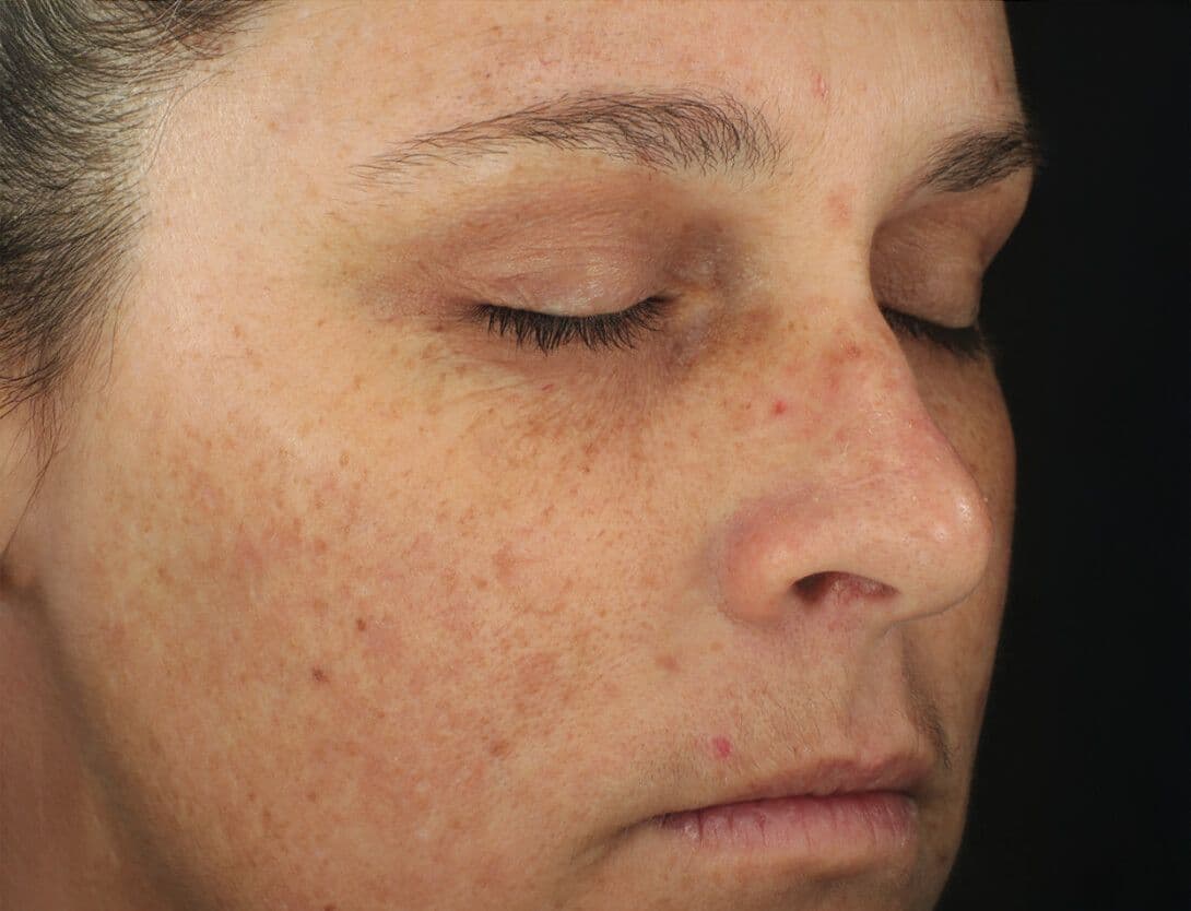 DiamondGlow-2025-01-03 at 2.43.31-Before.jpg