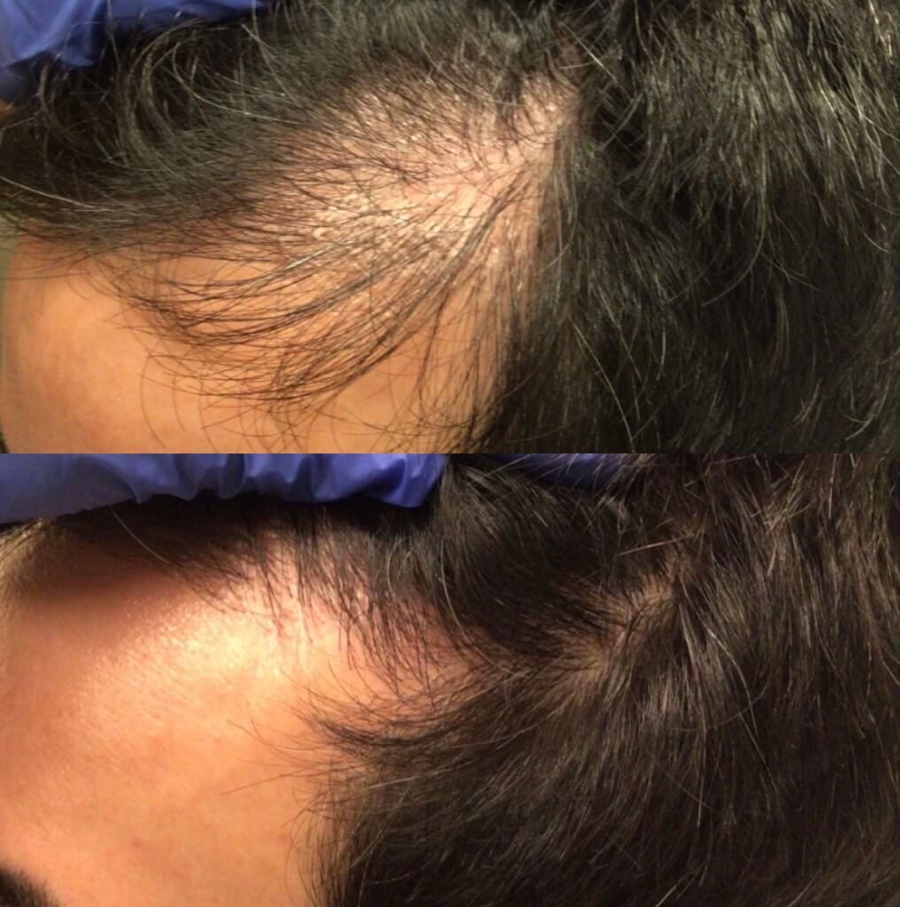 Hair Treatment | Before & After Image | Revive Salon And Spa