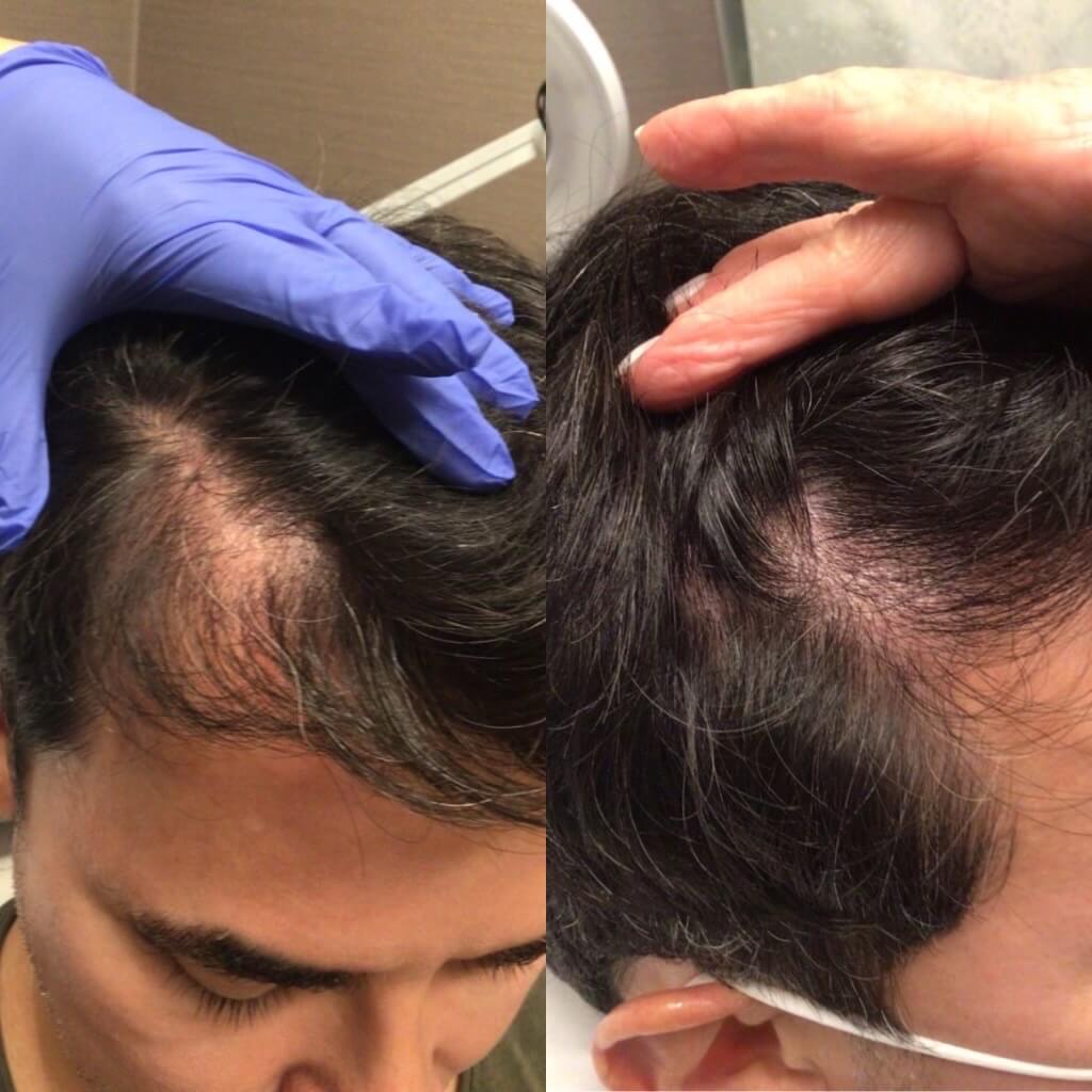Hair Treatment | Before & After Image | Revive Salon And Spa